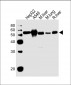ALDH2 Antibody (N-term)